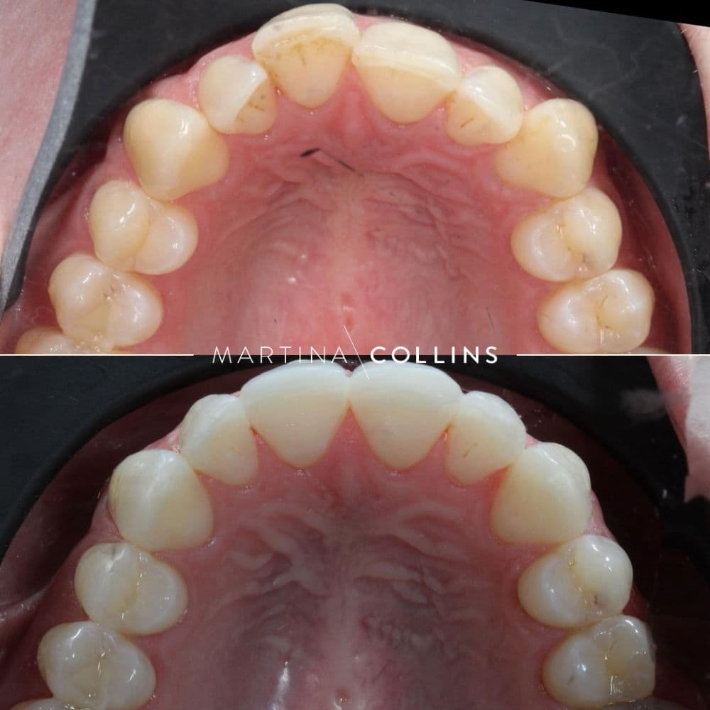 Dr Robyn - Invisalign.jpg