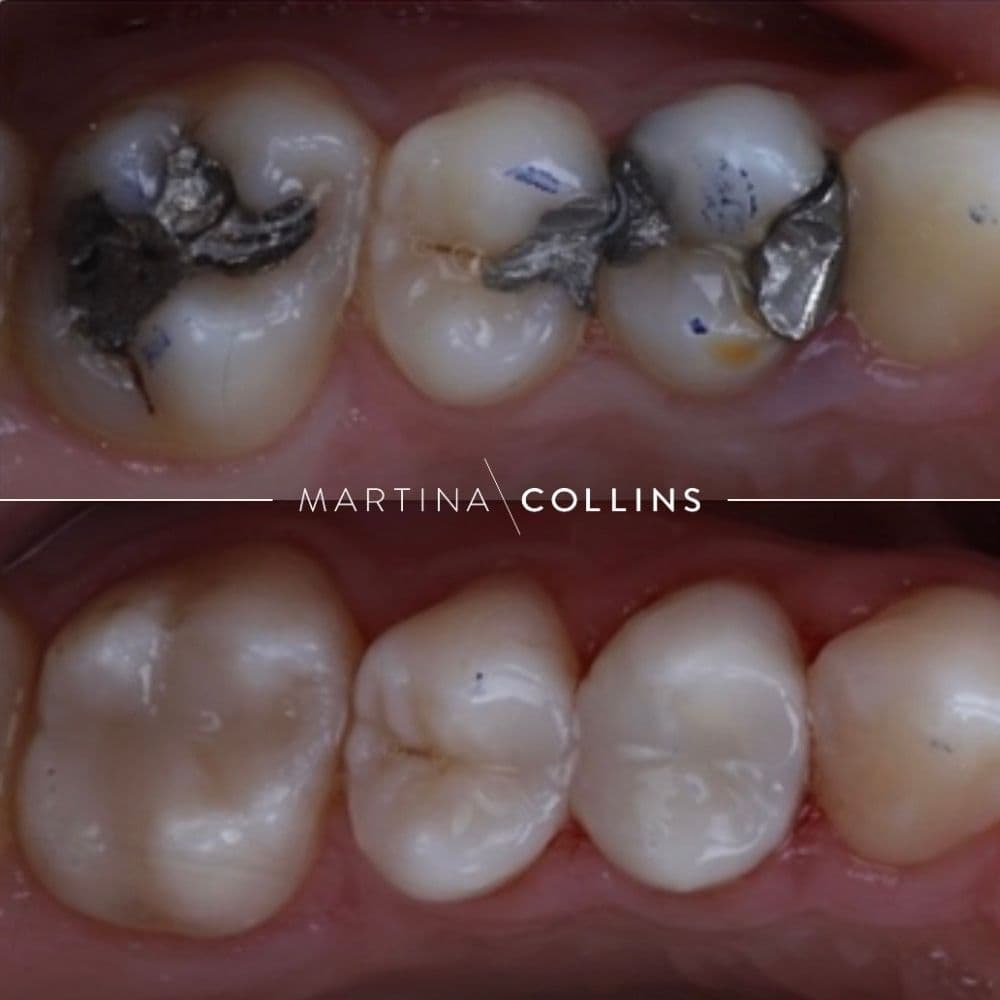 Dr. David - Silver to White.jpg