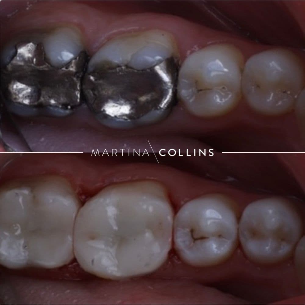 Silver to White - Dr. David J.jpg